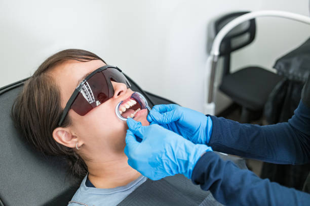 Best Knocked-Out Tooth (Avulsed Tooth) Treatment in Indianola, WA